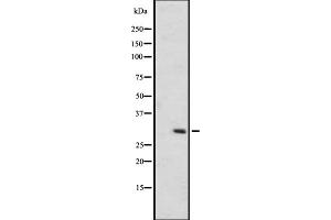 Western blot analysis of OR6C75 expression in A431 whole cell lysate ,The lane on the left is treated with the antigen-specific peptide. (OR6C75 antibody)