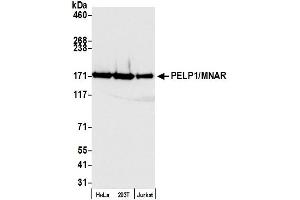 Western Blotting (WB) image for anti-Proline-, Glutamic Acid- and Leucine-Rich Protein 1 (PELP1) (AA 1000-1050) antibody (ABIN7453550) (PELP1 antibody  (AA 1000-1050))