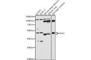Western blot analysis of extracts of various cell lines, using P antibody (ABIN6132104, ABIN6140406, ABIN6140407 and ABIN6224794) at 1:1000 dilution. (F2RL1 antibody  (AA 318-397))