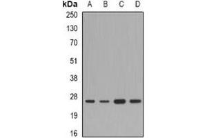 Western blot analysis of FAM173B expression in A549 (A), mouse liver (B), mouse heart (C), rat brain (D) whole cell lysates. (FAM173B antibody)
