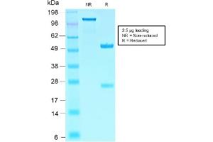 SDS-PAGE (SDS) image for anti-SRY (Sex Determining Region Y)-Box 10 (SOX10) (AA 115-269) antibody (ABIN6940628)