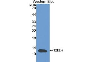 Western Blotting (WB) image for anti-Cystatin B (Stefin B) (CSTB) (AA 2-98) antibody (ABIN1077972) (CSTB antibody  (AA 2-98))
