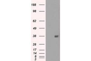 Image no. 6 for anti-Fc gamma RII (CD32) antibody (ABIN1497256) (Fc gamma RII (CD32) antibody)