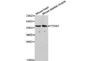 Western blot analysis of extracts of various cell lines, using PDHA1 antibody. (PDHA1 antibody  (AA 30-390))