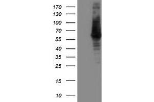 HEK293T cells were transfected with the pCMV6-ENTRY control (Left lane) or pCMV6-ENTRY ILVBL (Right lane) cDNA for 48 hrs and lysed. (ILVBL antibody)