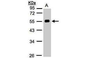 Western Blotting (WB) image for anti-Angiotensinogen (serpin Peptidase Inhibitor, Clade A, Member 8) (AGT) antibody (ABIN2855709)