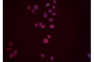 ABIN6276553 staining Hela cells by IF/ICC. (DUSP6 antibody  (Internal Region))