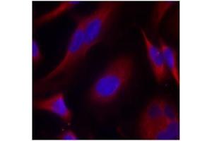 Image no. 2 for anti-Protein Kinase D1 (PRKD1) (Ser738) antibody (ABIN197313) (PKC mu antibody  (Ser738))