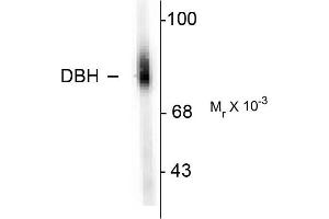 Western blots of human adrenal medulla lysate showing specific immunolabeling of the ~75k DBH protein. (DBH antibody  (N-Term))