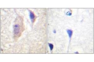 Immunohistochemistry analysis of paraffin-embedded human brain, using Bcr (Phospho-Tyr360) Antibody. (BCR antibody  (pTyr360))