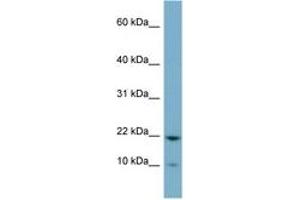 Image no. 1 for anti-Desumoylating Isopeptidase 1b (DESI1B) (C-Term) antibody (ABIN6741787)