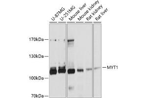 Western blot analysis of extracts of various cell lines, using MYT1 antibody (ABIN6129057, ABIN6144304, ABIN6144305 and ABIN6215004) at 1:1000 dilution. (MYT1 antibody  (AA 650-820))