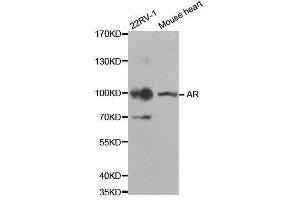 Western blot analysis of extracts of various cell lines, using AR antibody. (Androgen Receptor antibody)