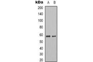 Western blot analysis of Pyruvate Kinase expression in MCF7 (A), HepG2 (B) whole cell lysates. (Pyruvate Kinase antibody)