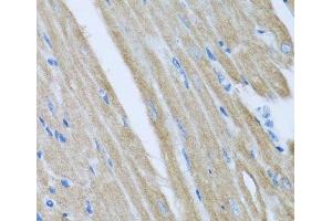 Immunohistochemistry of paraffin-embedded Mouse heart using CCM2 Polyclonal Antibody at dilution of 1:100 (40x lens). (CCM2 antibody)