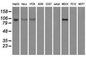Image no. 3 for anti-Hexokinase 2 (HK2) antibody (ABIN1498647) (Hexokinase 2 antibody)