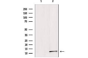 SUMO1 antibody  (N-Term)