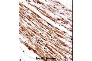 Immunohistochemistry (Formalin/PFA-fixed paraffin-embedded sections) of human heart tissue with PLA2G5 polyclonal antibody  followed by peroxidase conjugation of the secondary antibody and DAB staining. (PLA2G5 antibody  (AA 103-132))
