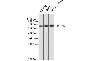 Western blot analysis of extracts of various cell lines using PTPN6 Polyclonal Antibody at dilution of 1:1000. (SHP1 antibody)