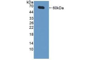 Detection of Recombinant XIAP, Human using Polyclonal Antibody to X-linked Inhibitor Of Apoptosis Protein (XIAP) (XIAP antibody  (AA 1-497))