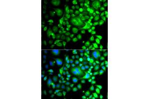 Immunofluorescence analysis of A549 cells using SNX3 antibody (ABIN6290935). (Sorting Nexin 3 antibody)