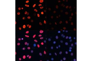 Immunofluorescence analysis of C6 cells using Acetyl-Histone H3-K18 antibody (ABIN7267668) at dilution of 1:100. (Histone 3 antibody  (H3K18))