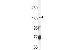 Western Blotting (WB) image for anti-ATP-Binding Cassette, Sub-Family C (CFTR/MRP), Member 3 (ABCC3) (AA 899-925) antibody (ABIN5647959)