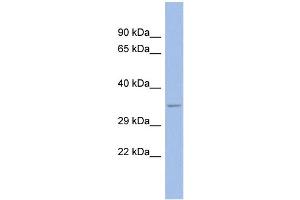 WB Suggested Anti-SPP1 Antibody Titration: 0.