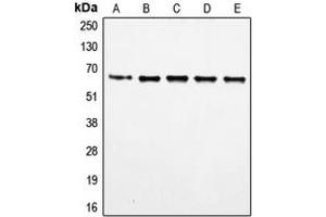Western blot analysis of FOXO4 (pS197) expression in HeLa (A), MM142 (B), HuT78 (C), HEK293T (D), NIH3T3 (E) whole cell lysates. (FOXO4 antibody  (pSer197))
