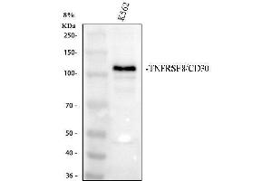 Western blot analysis of CD30 using anti-CD30 antibody (ABIN3043717).