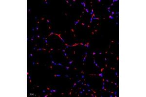 Immunofluorescence of paraffin embedded mouse Skeletal muscle using RB1 (ABIN7075477) at dilution of 1:1400 (400x lens) (RBM45 antibody)