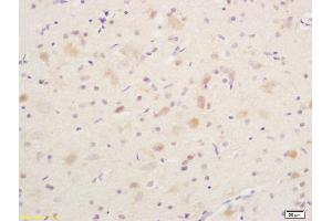 Formalin-fixed and paraffin embedded rat brain labeled with Anti phospho-B-Raf (Ser365) Polyclonal Antibody, Unconjugated (ABIN682888) at 1:200 followed by conjugation to the secondary antibody and DAB staining (SNRPE antibody  (pSer365))