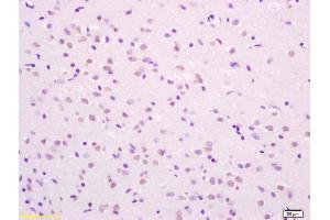 Formalin-fixed and paraffin embedded rat brain labeled with Rabbit Anti phospho-SHC(Ser36) Polyclonal Antibody, Unconjugated (ABIN745913) at 1:200 followed by conjugation to the secondary antibody and DAB staining (SHC1 antibody  (pSer36))