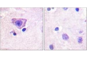 Immunohistochemistry analysis of paraffin-embedded human brain, using RyR2 (Phospho-Ser2808) Antibody. (RYR2 antibody  (pSer2808))