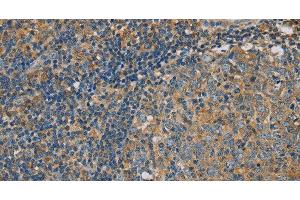 Immunohistochemistry of paraffin-embedded Human tonsil using CLIC1 Polyclonal Antibody at dilution of 1:30 (CLIC1 antibody)