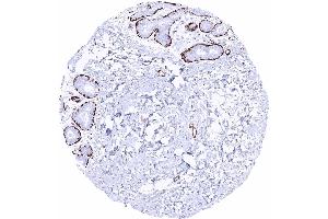 Breast Caldesmon h staining of myoepithelial cells Caldesmon h immunohistochemistry (Recombinant Caldesmon antibody)