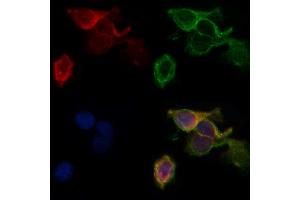 ABIN6260492 and ABIN6268884 staining HepG2 by IF/ICC.