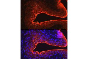 Immunofluorescence analysis of rat bladder using UPK3A Rabbit pAb (ABIN6128904, ABIN6149950, ABIN6149951 and ABIN6214142) at dilution of 1:100 (40x lens). (Uroplakin 3A antibody  (AA 19-207))
