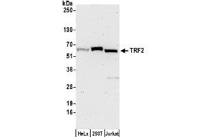 anti-TBP-Like 1 (TBPL1) (AA 375-425) antibody