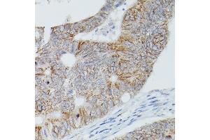 Immunohistochemistry (IHC) image for anti-Alkaline Phosphatase, Liver/bone/kidney (ALPL) (AA 20-270) antibody (ABIN1512569)