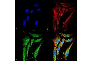 Immunocytochemistry/Immunofluorescence analysis using Mouse Anti-MMP9 Monoclonal Antibody, Clone S51-82 . (MMP 9 antibody  (AA 1-708) (Biotin))