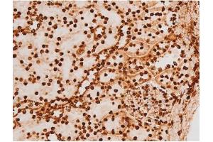 Immunohistochemistry (IHC) image for anti-REL proto-oncogene (c-Rel) (pSer503) antibody (ABIN6255382)