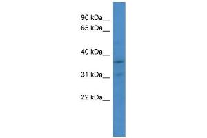 WB Suggested Anti-CDK2 Antibody Titration: 1. (CDK2 antibody  (Middle Region))