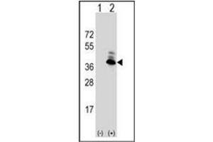 Image no. 5 for anti-Aspartoacylase (ASPA) (AA 89-118), (N-Term) antibody (ABIN452768) (ASPA antibody  (N-Term))