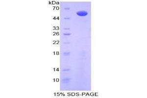 SDS-PAGE analysis of Human Glypican 3 Protein. (Glypican 3 Protein (GPC3))