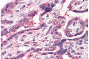 Human Placenta (formalin-fixed, paraffin-embedded) stained with TFF2 antibody ABIN351426 at 15 ug/ml followed by biotinylated goat anti-rabbit IgG secondary antibody ABIN481713, alkaline phosphatase-streptavidin and chromogen. (Trefoil Factor 2 antibody  (Internal Region))