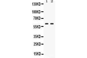 Western blot analysis of GPI expression in human placenta extract ( Lane 1) and JURKAT whole cell lysates ( Lane 2). (GPI antibody  (N-Term))