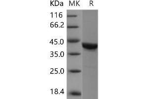 Western Blotting (WB) image for Casein Kinase 2 alpha 1 (CSNK2A1) protein (ABIN7320134) (CSNK2A1/CK II alpha Protein)