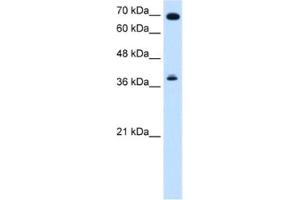 Western Blotting (WB) image for anti-Forkhead Box J1 (FOXJ1) antibody (ABIN2461630)