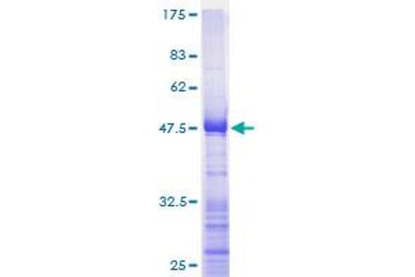RPL17 Protein (AA 1-184) (GST tag)